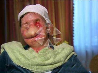 حمله میمون به یک زن میانسال به قصد تجاوز حمله میمون به یک زن میانسال به قصد تجاوز