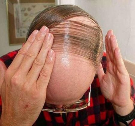عکس مدل موهای خنده دار مردان کچل