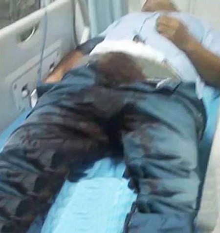 اخته شدن مرد بیچاره با دندان های همسرش (تصاویر 18+) اخته شدن مرد بیچاره با دندان های همسرش (تصاویر 18+)