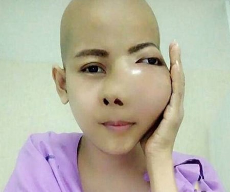 زیباترین دختر دنیا با یک تومور وحشتناک روی صورت + تصاویر زیباترین دختر دنیا با یک تومور وحشتناک روی صورت + تصاویر