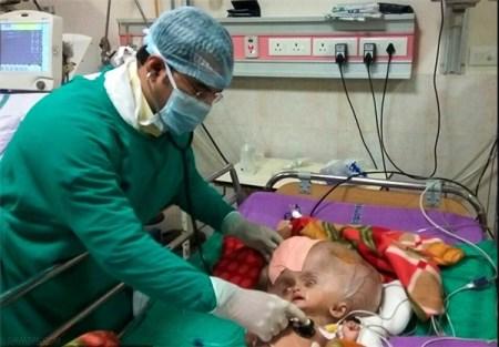 نوزاد 7 ماهه ای که سرش به اندازه سر فیل است + تصاویر