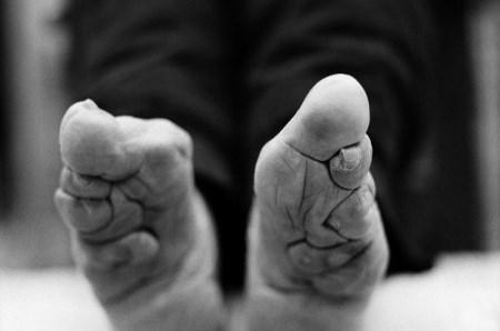 سنت وحشتناک و عجیب تغییر شکل بدن در قبایل عقب افتاده (18+) سنت وحشتناک و عجیب تغییر شکل بدن در قبایل عقب افتاده (18+)