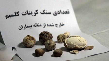 اجسام زبر و خطرناکی که از بدن بیماران خارج شدند!+ تصاویر اجسام زبر و خطرناکی که از بدن بیماران خارج شدند!+ تصاویر