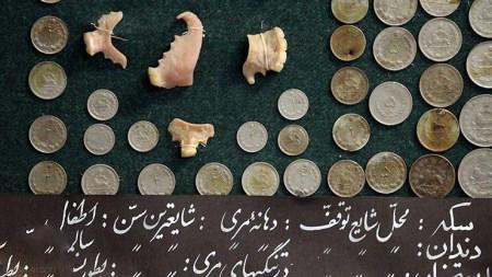 اجسام زبر و خطرناکی که از بدن بیماران خارج شدند!+ تصاویر اجسام زبر و خطرناکی که از بدن بیماران خارج شدند!+ تصاویر
