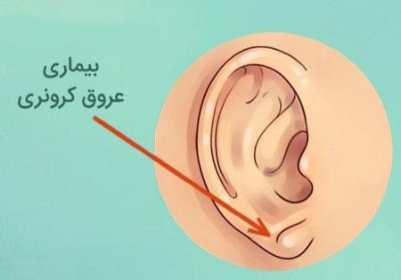طرح و رنگ گوش شما بیانگر حقایقی می باشد + تصاویر طرح و رنگ گوش شما بیانگر حقایقی می باشد + تصاویر