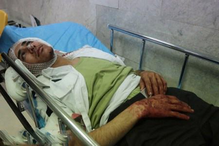 تصاویر تکان دهنده از برخورد ترقه پیازی با خودروی پلیس مشهد تصاویر تکان دهنده از برخورد ترقه پیازی با خودروی پلیس مشهد