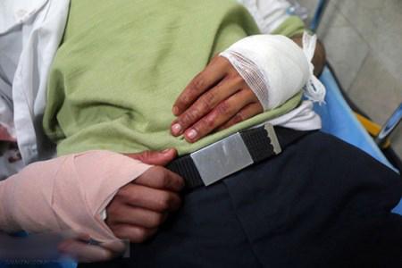 تصاویر تکان دهنده از برخورد ترقه پیازی با خودروی پلیس مشهد تصاویر تکان دهنده از برخورد ترقه پیازی با خودروی پلیس مشهد