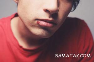 علت تبخال چیست + درمان تبخال در طب سنتی 4 495596360 samatak com