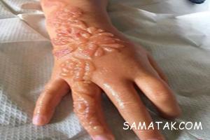 1776533018 samatak com