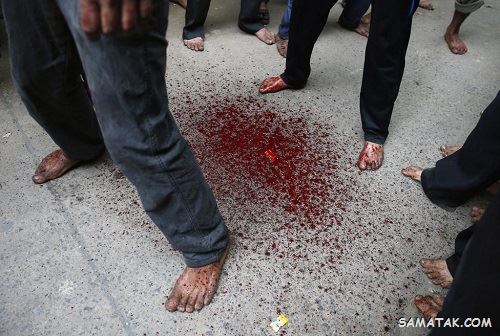 تصاویر وحشتناک از قمه زنی مسلمانان در روز عاشورا تصاویر وحشتناک از قمه زنی مسلمانان در روز عاشورا