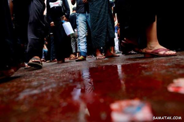 تصاویر وحشتناک از قمه زنی مسلمانان در روز عاشورا تصاویر وحشتناک از قمه زنی مسلمانان در روز عاشورا