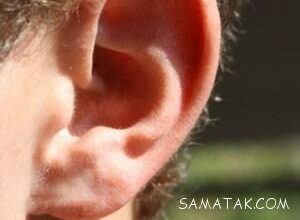 جوش داخل گوش نشانه چیست 27 525828628 samatak com