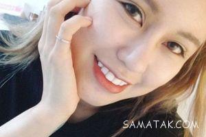 دختر زیبایی که 30 عمل جراحی زیبایی کرده است 5 1977463707 samatak com