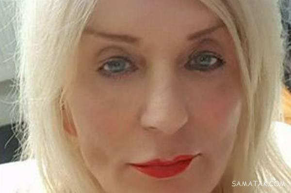 پیرزن 85 ساله با جراحی پلاستیک 40 سال جوان شد