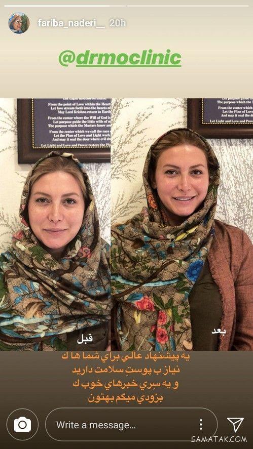لایو استوری بازیگران و سلبریتی های معروف در اینستا لایو استوری بازیگران و سلبریتی های معروف در اینستا
