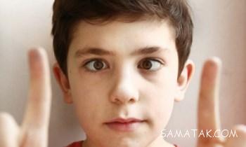 تنبلی چشم در کودکان زیر پنج سال 23 1561550063 samatak com