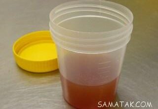تست بارداری با نمک چگونه است 6 1992411780 samatak com