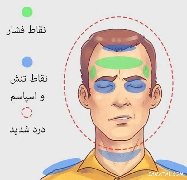 نحوه تشخیص نوع سردرد + عکس انواع سردردها
