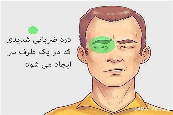 نحوه تشخیص نوع سردرد + عکس انواع سردردها