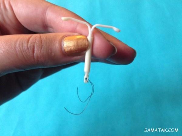 دستگاه آی یو دی چیست | مراقبتهای بعد از گذاشتن دستگاه آی یو دی iud