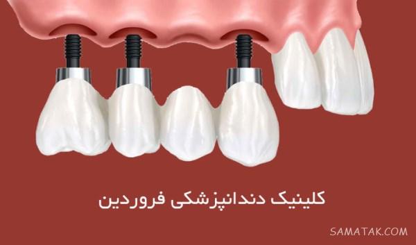 عکس نوشته متولدین فروردین برای پروفایل + عکس پروفایل برای فروردین ماهی ها عکس نوشته متولدین فروردین برای پروفایل + عکس پروفایل برای فروردین ماهی ها