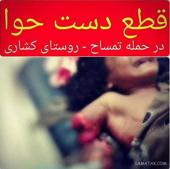 حمله تمساح به دختر بچه در سرباز (تصاویر 16+) حمله تمساح به دختر بچه در سرباز (تصاویر 16+)