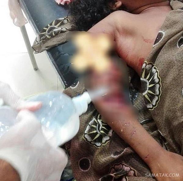 حمله تمساح به دختر بچه در سرباز (تصاویر 16+) حمله تمساح به دختر بچه در سرباز (تصاویر 16+)