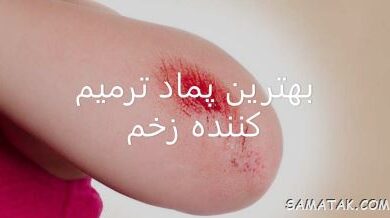 پماد ترمیم کننده زخم + بهترین پماد برای از بین بردن جای زخم 6 814739417 samatak com