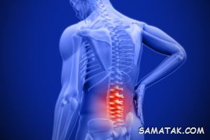 بهترین دارو برای استخوان درد | مسکن قوی برای درد استخوان 6 1470646390 samatak com
