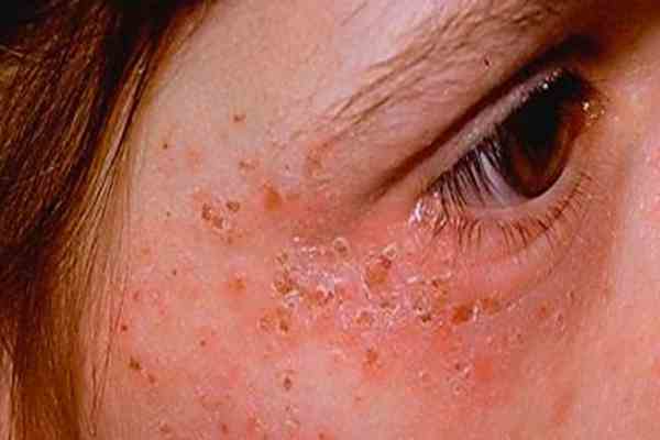عجیب ترین بیماری های جهان