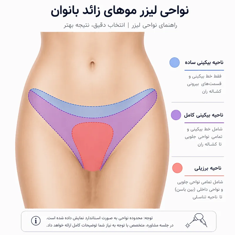 لیزر بیکینی شامل کجا است؟ نواحی دقیق + لباس و عوارض 1 نواحی بدن که لیزر بیکینی شامل آنها میشود