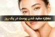 معجزه سفید شدن پوست در یک روز