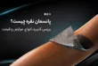 پانسمان نقره چیست
