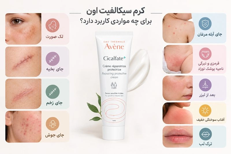 کرم سیکالفیت اون چه کاربردهایی دارد؟ 2 ترمیم کننده سیکالفیت اون برای چی خوبه؟